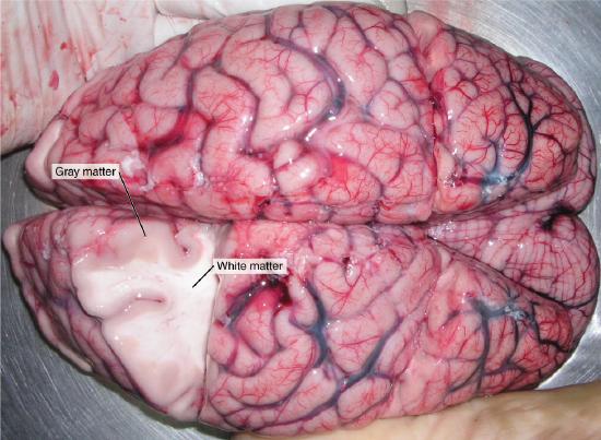 White and gray matter indicated on a fresh human brain dissection