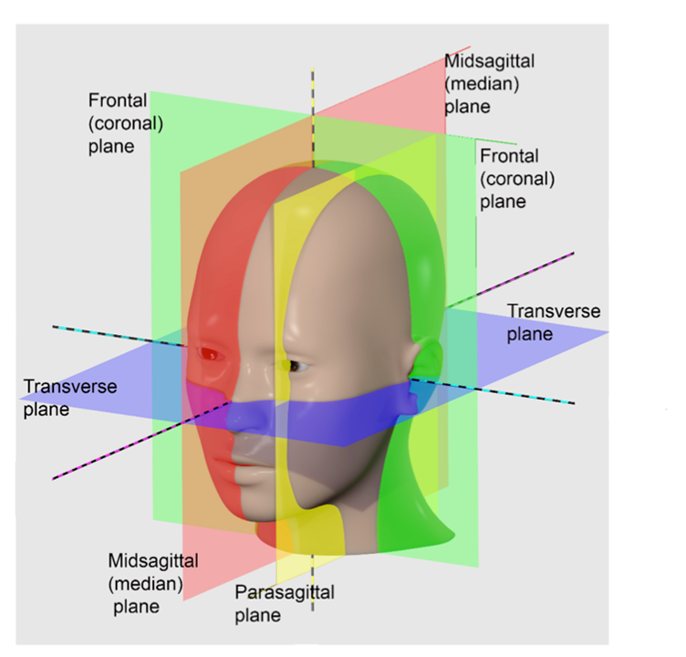 Imagen de la cabeza de una persona, mostrando los planos transversal, frontal (coronal) y sagital (midsagital y parasagittal)
