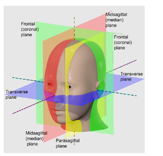 Image of a person's head, showing transverse, frontal (coronal), and sagittal (midsagittal and parasagittal) planes