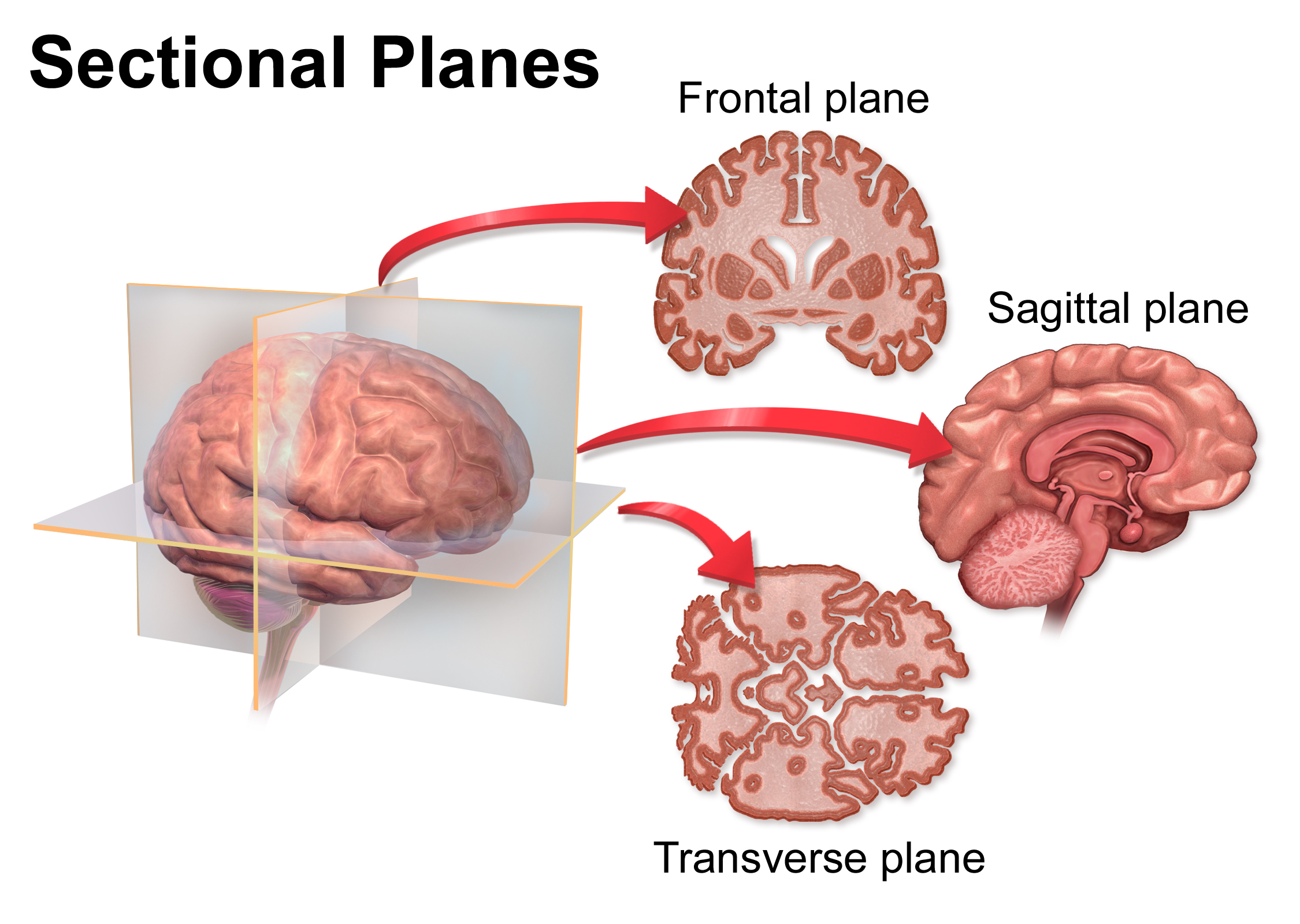 Diagrama de planos seccionales a través del cerebro humano: frontal, sagital y transversal.