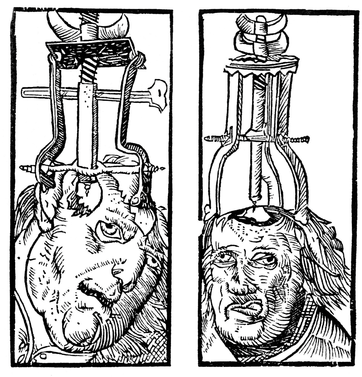 A drawing of holes being drilled into the skull.