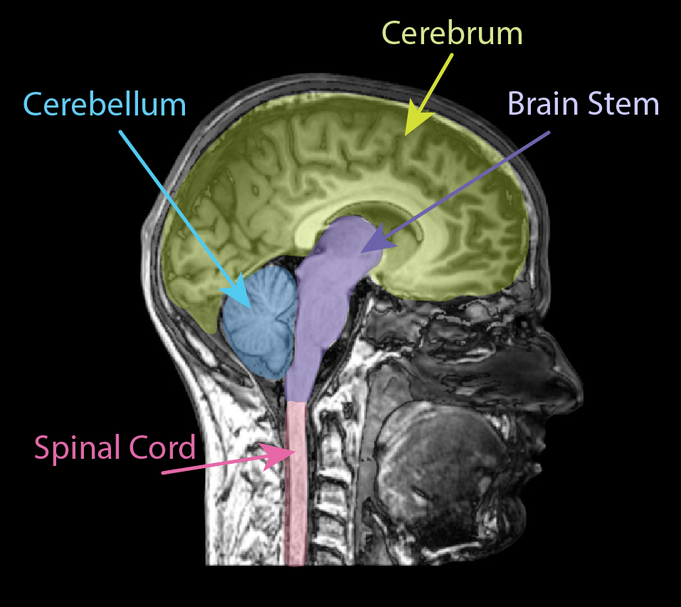 Imagen por resonancia magnética de un cerebro humano con el cerebro, cerebelo, tronco encefálico y médula espinal indicados en diferentes colores
