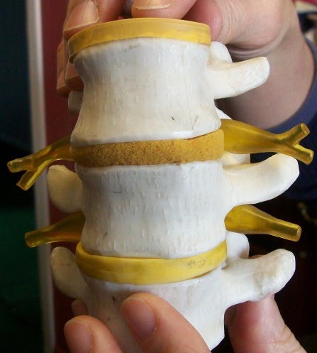 Modelo de tres vértebras con relleno entre cada vértebra y nervios espinales que se extienden desde cada lado