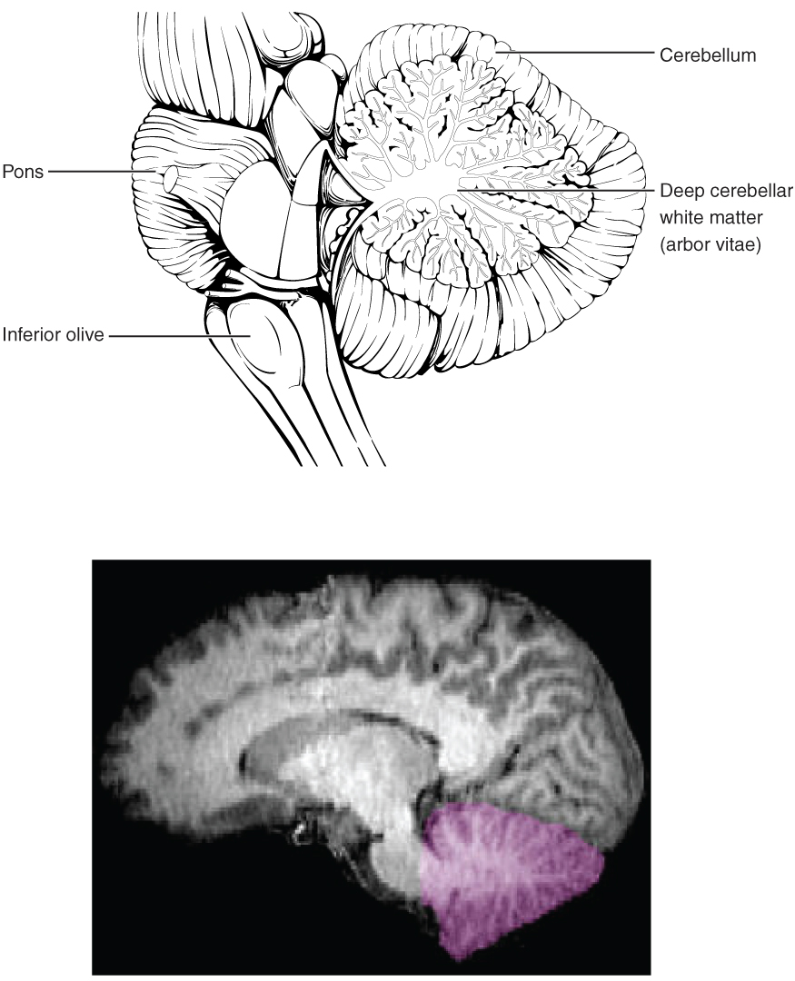 Dibujo cerebeloso, con estructuras de subtítulo y materia blanca cerebelosa profunda (arbor vitae); MRI de cerebro/cerebelo