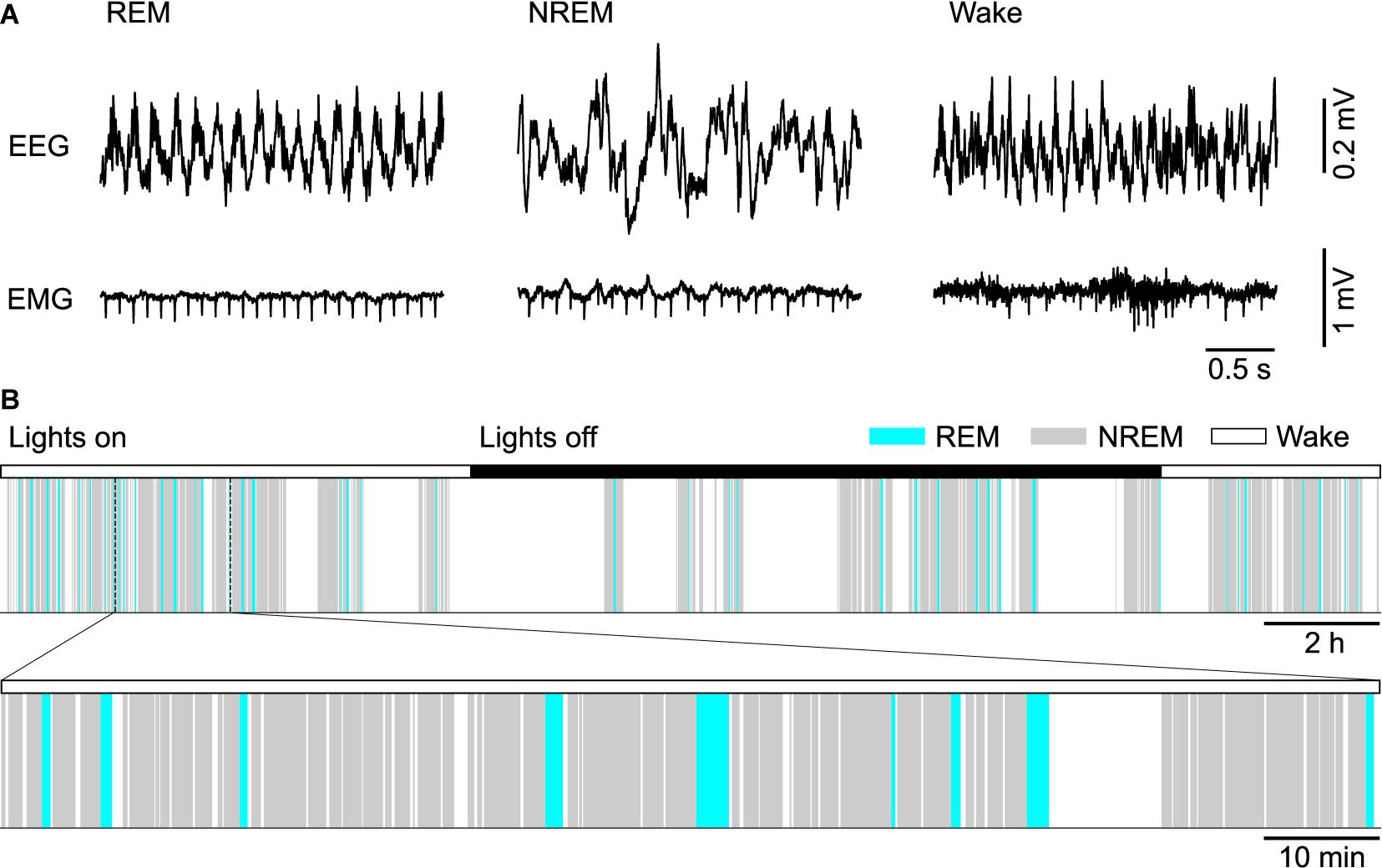 A - Grabaciones EEG y EMG de un ratón cuando está en REM, NREM y vigilia, B - vigilia de sueño y periodos NREM con inserción de 2 horas