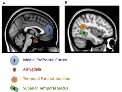 Two sagittal images with brain parts involved in self processing in different colors