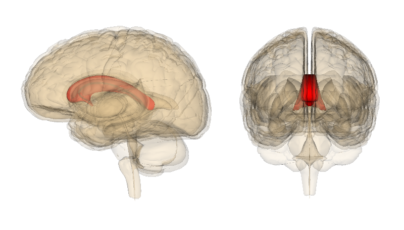Una imagen del cerebro generada por computadora (vista lateral y anterior) muestra el cuerpo calloso profundo dentro del cerebro