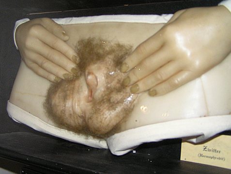 Wax figure of pubic area showing a small penis (or enlarged clitoris) with an opening below it, between the testes