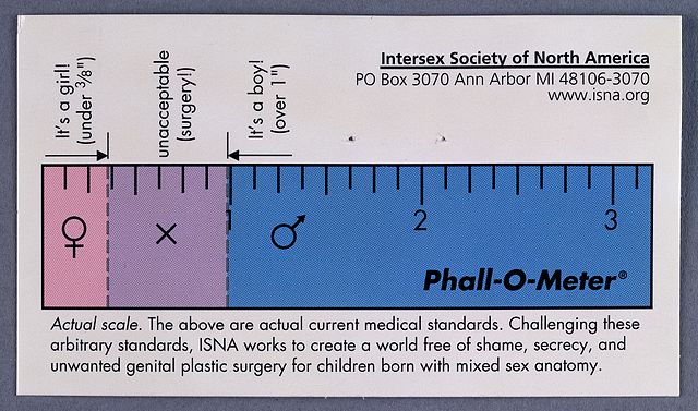 A ruler: under 3/8 inch marked "It's a girl!, middle marked "unacceptable (surgery!)" & over 1 inch marked "It's a boy!"