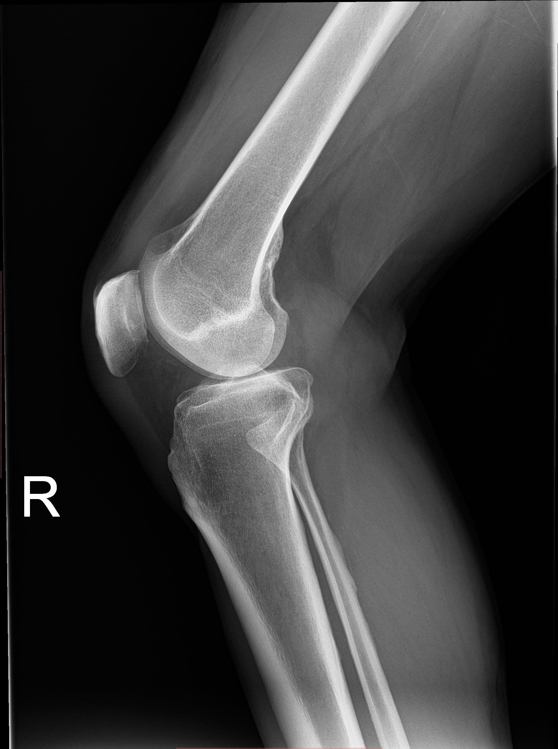 Rayos X de una rodilla