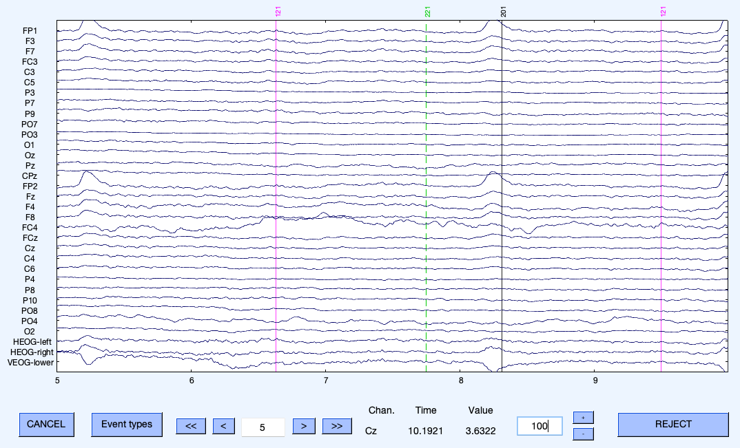 6 EEG_Blinks.png