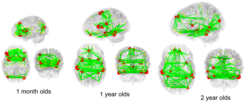 Ubicación y conexiones entre los diez mejores centros de redes cerebrales. Este gráfico muestra los datos proporcionados en la leyenda de la figura
