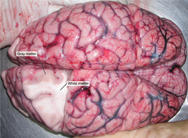 Gray Matter and White Matter A brain removed during an autopsy, with a partial section removed, shows white matter surrounded by gray matter. Gray matter makes up the outer cortex of the brain. 