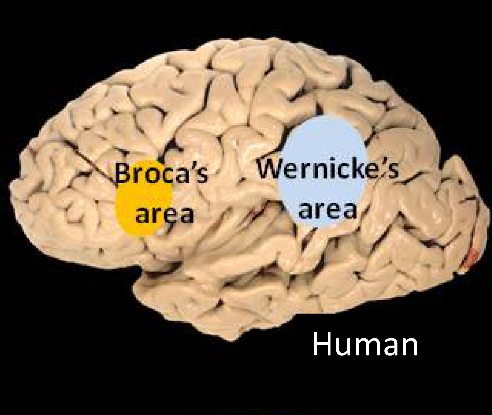 Broca 's_and_wernicke' s_areas.png