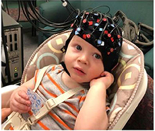 vista frontal del infante con gorra FNIRS puesta. La tapa cubre la cabeza de bebés con sensores conectados a computadoras. .png