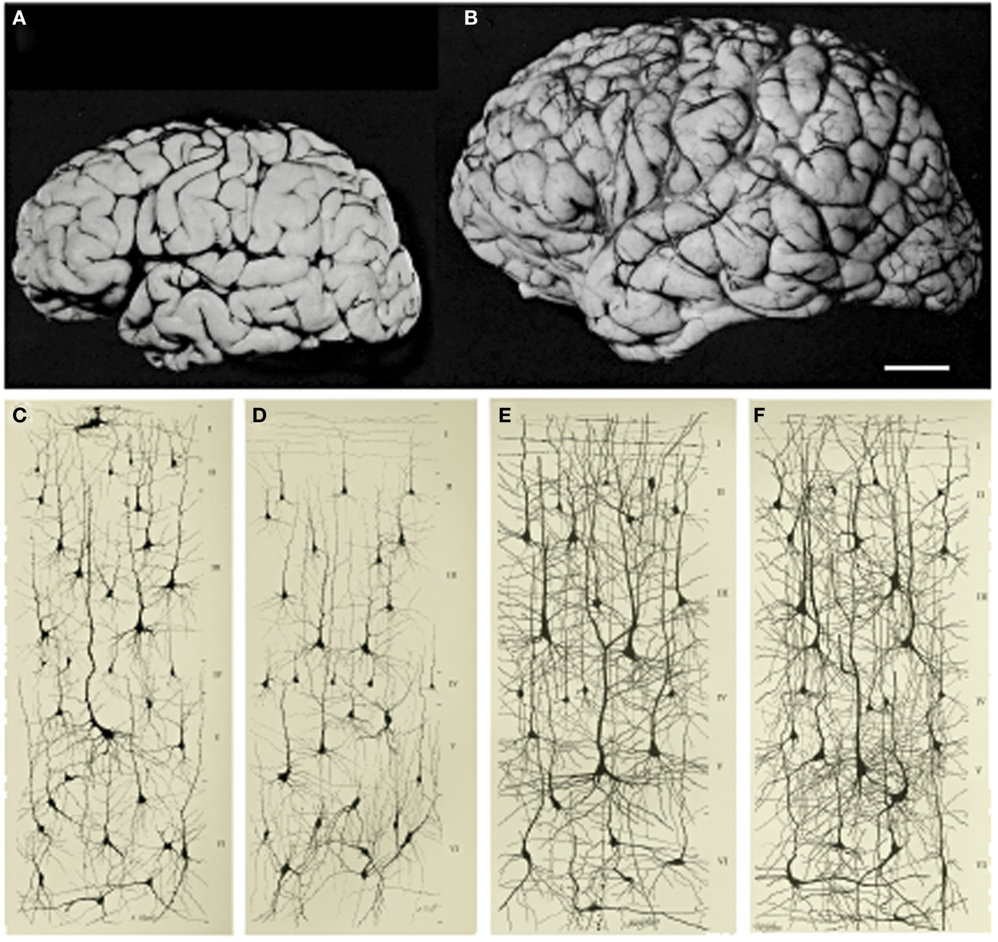 Photographs of the brains from a one-month and a six-year-old child, with drawings of neurons, as described in the caption 