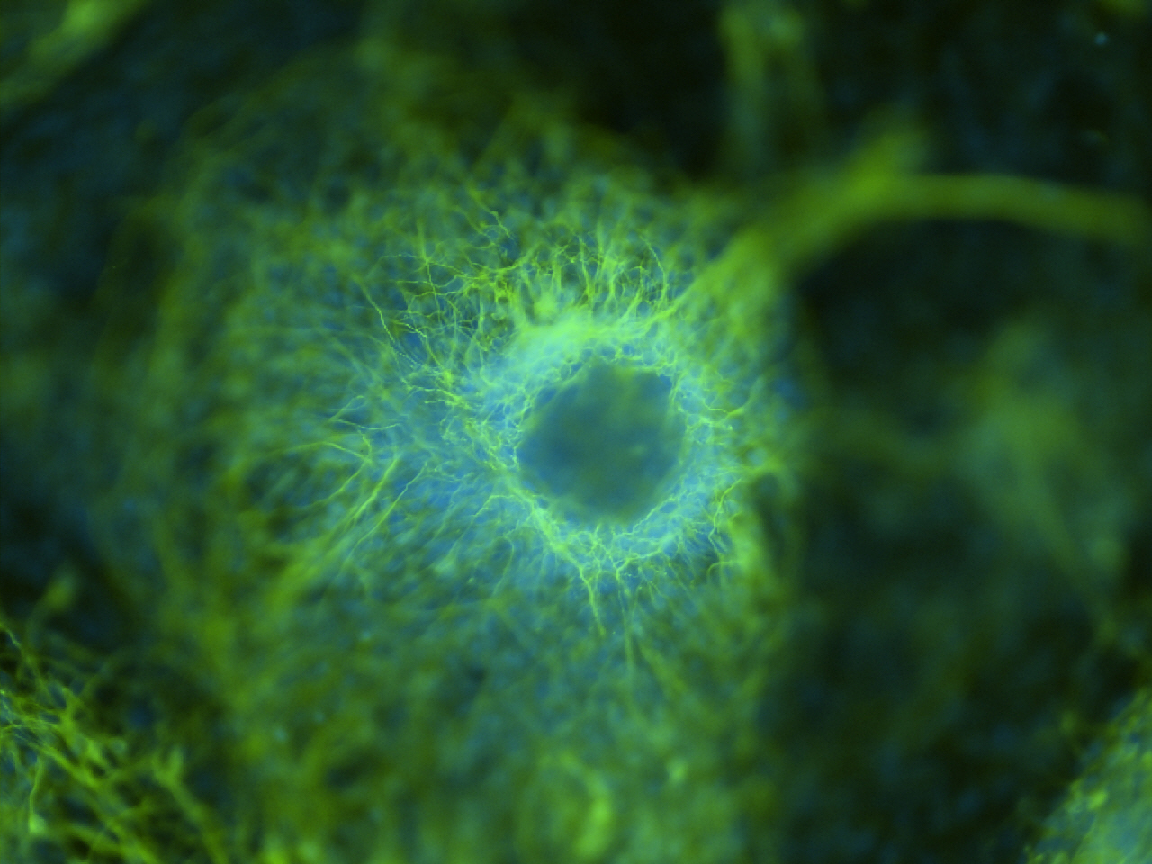 Un grupo de neuronas en desarrollo se tiñeron de verde y núcleos teñidos de azul