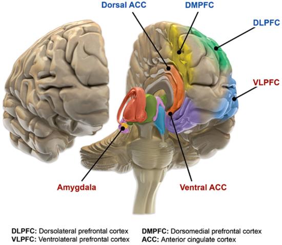 Regions of the brain in bipolar disorders.jpg