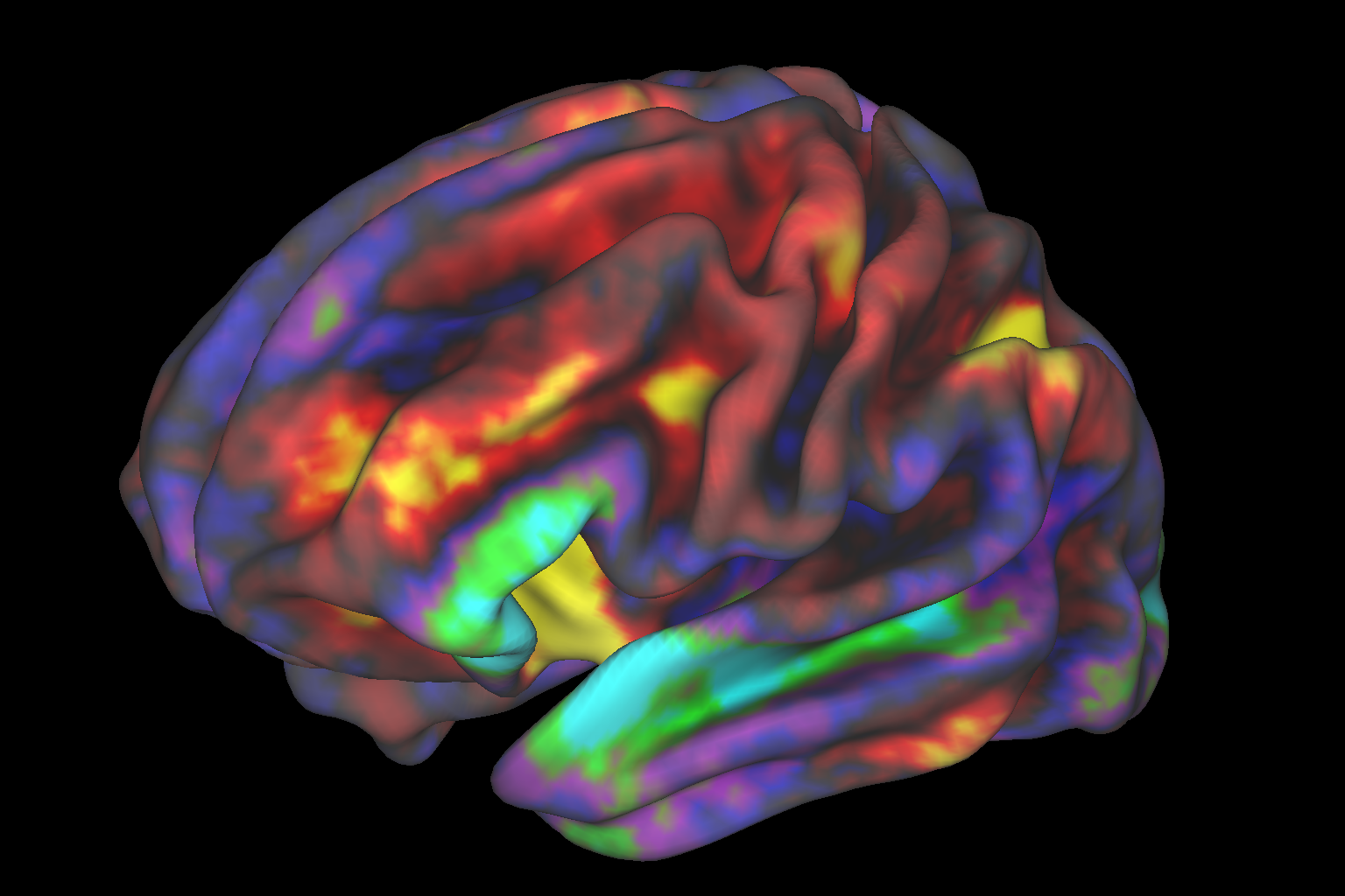 Functional MRI of a brain