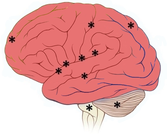 Diagrama del cerebro humano con áreas de placer marcadas: frontal, centro, espalda, cerca de la fisura lateral, pons y cerebelo