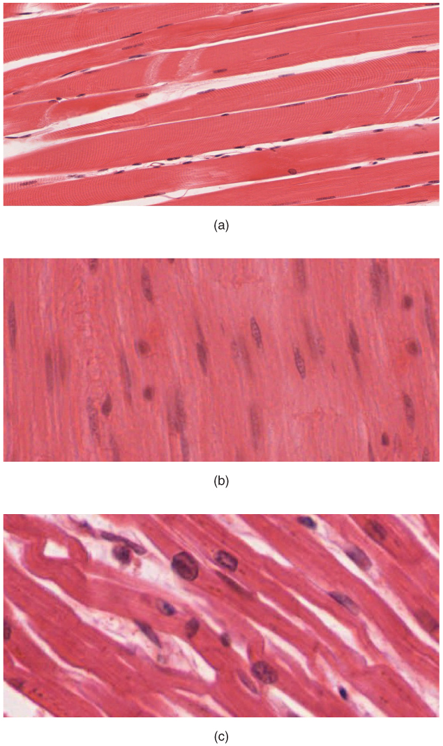 Micrografías de tejido muscular esquelético, liso y cardíaco