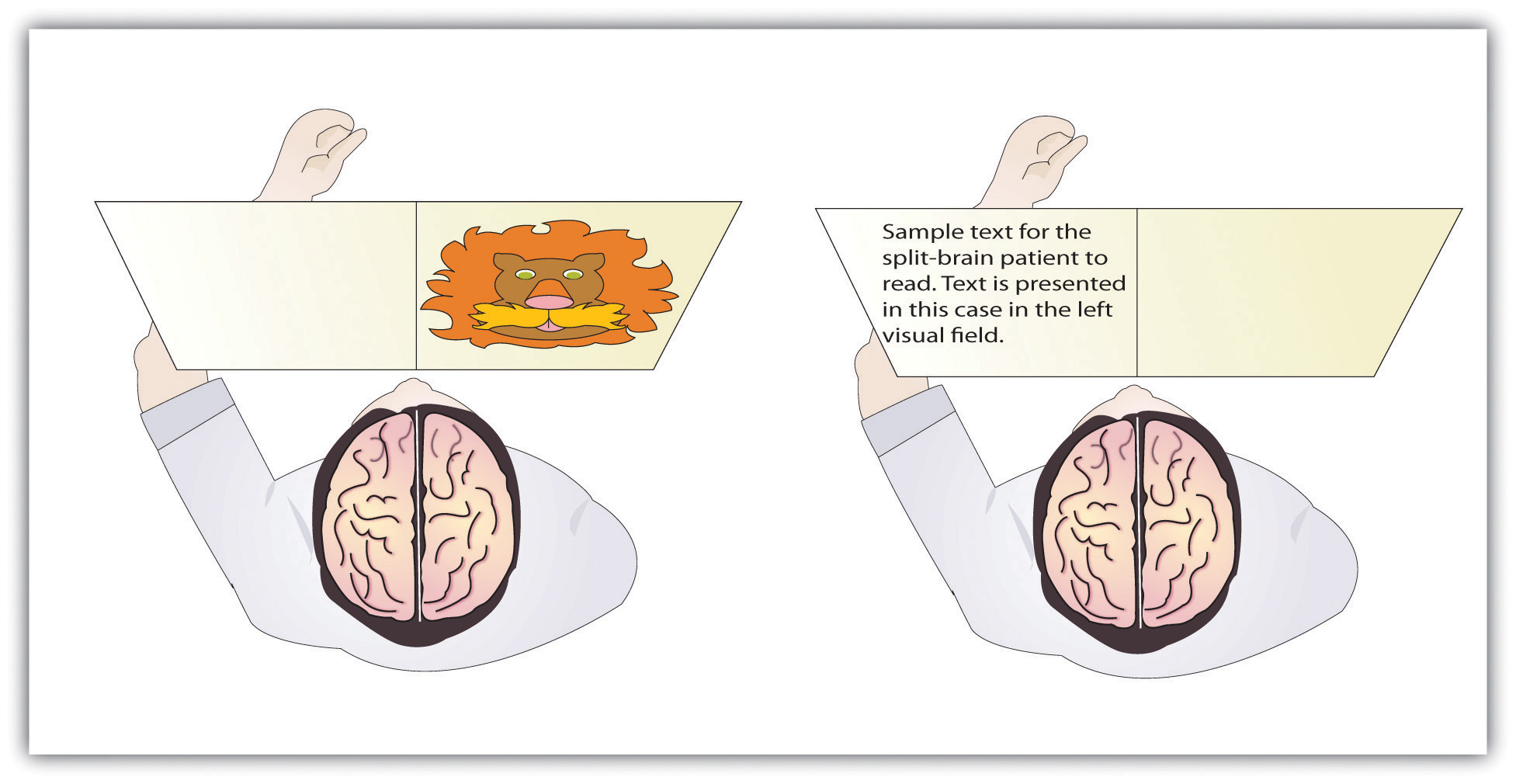Two split brain patients. One looks at picture of lion in right visual field; the other looks at a page of writing in left visual field.