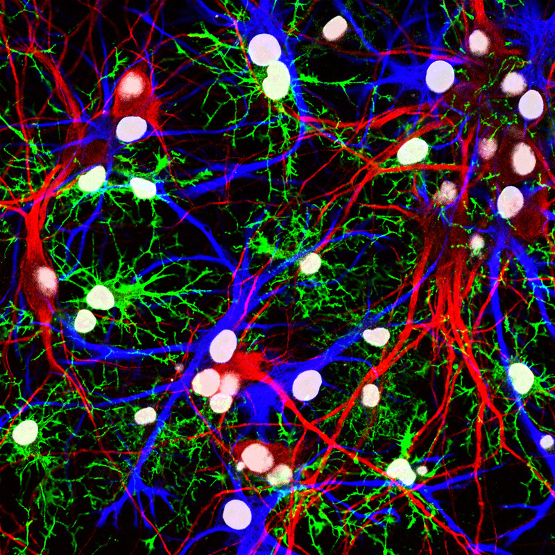 neurons and different types of glia from the hippocampus of a rat - shown in multicolor