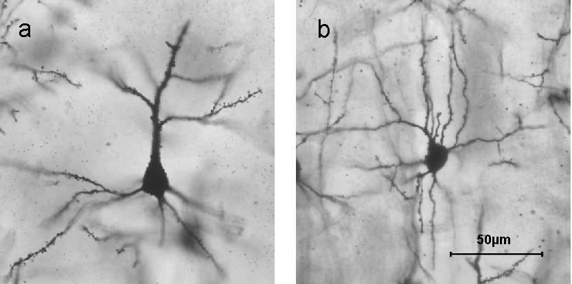 Foto de una neurona celular piramidal y una neurona estrellada espinosa cada una con dendritas ramificadas con espinas diminutas visibles. Ver texto.