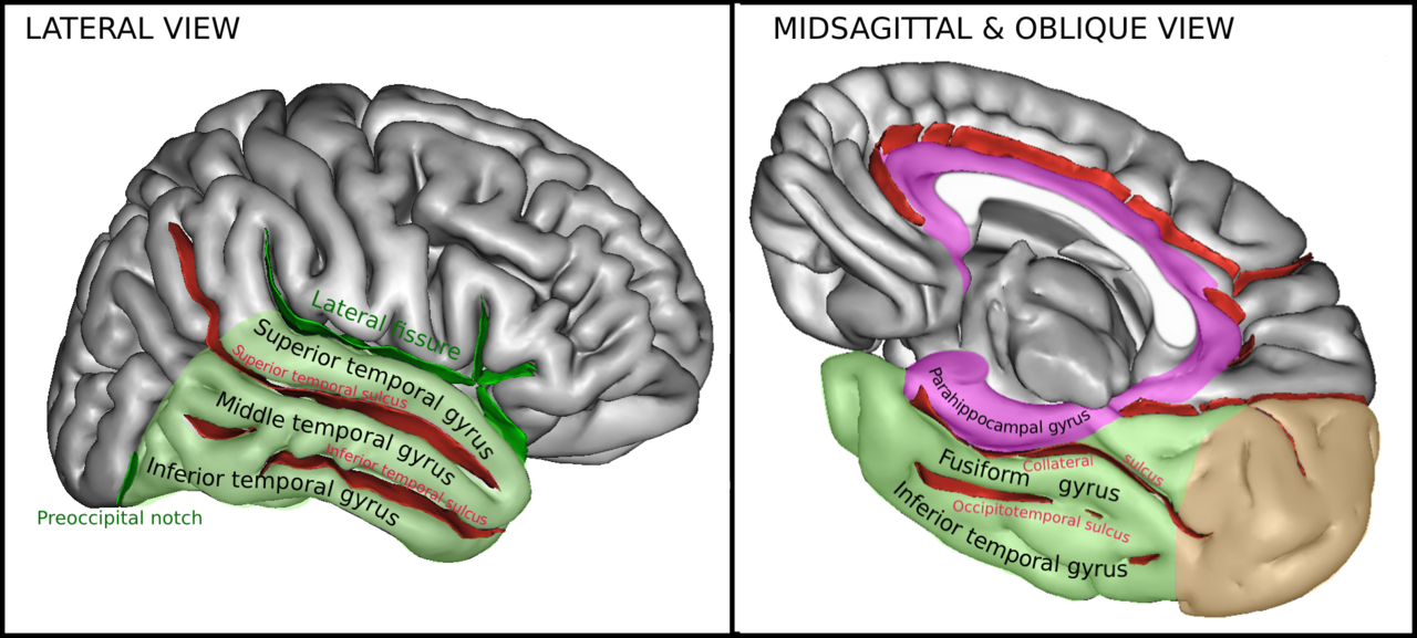 Two computer generated images showing views of human brain highlighting temporal lobe gyri and fissures.  See text.