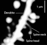File:Dendritic spines.jpg