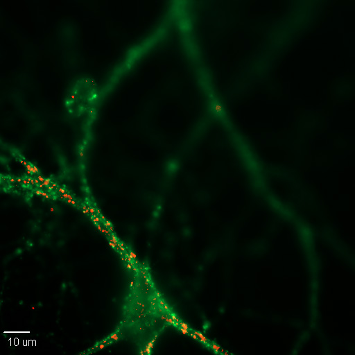 Iridescent green Cortical Neuron showing many synapses on it in green or red.  See text.