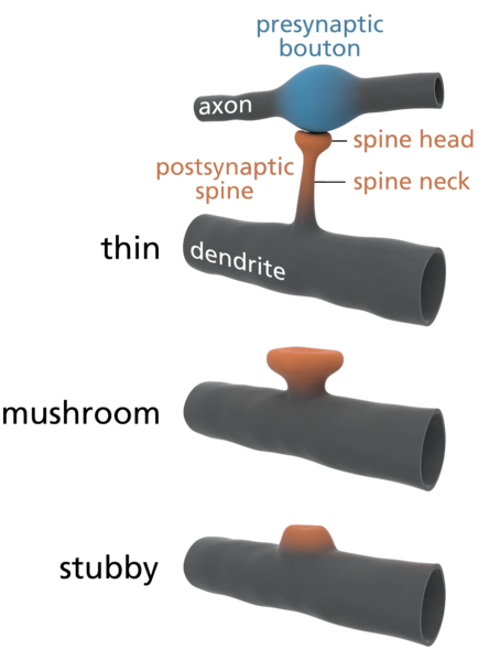A la izquierda, dibujos de diferentes tipos de espina dendrítica, caracterizadas por la forma. A la derecha, foto microscópica de una columna vertebral. Ver texto.
