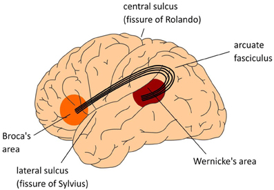 Three images of the human brain highlighting areas involved in language processing.  See text.