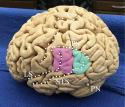 Superficial anatomy of the inferior parietal lobule.  See text.