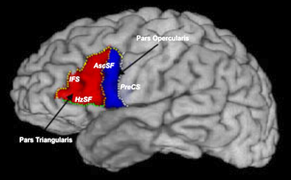 Broca's area and other regions of brain involved in language processing.  See text.