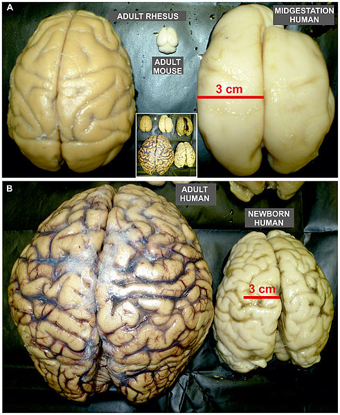 Photos from above of actual adult rat and non-human primate brains as well as developing and mature human brains. 